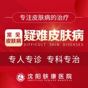 沈阳肤康皮肤医院讲解－手足口病高发季－避免交叉感染这样做